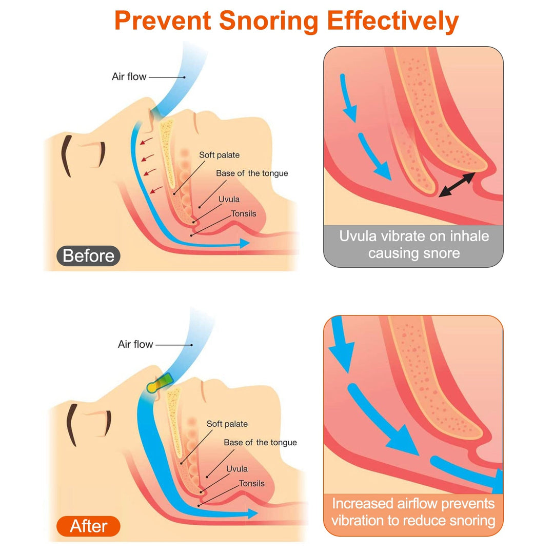 4Pcs Magnetic Nose Clip Anti Snoring Device Sleeping Aid Comfortable and Reusable for Men and Women