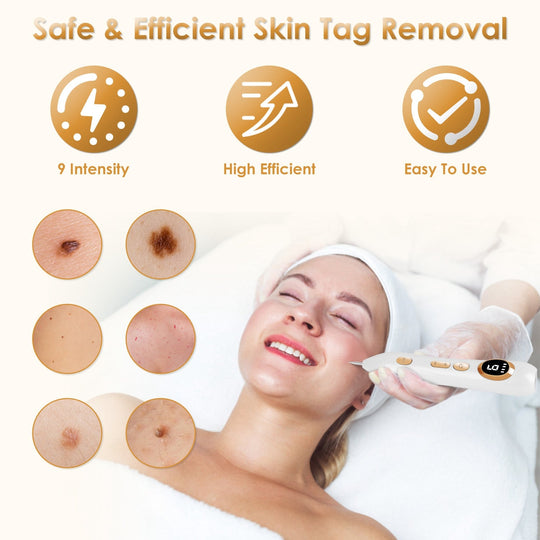 Portable Skin Tag Remover Pen with LED Light 9 Intensity Gears Cordless Rechargeable Skin Tag Removal Kit Intended for Common Warts Mole Skin Tags Gif